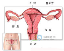 慢性子宫内膜炎 慢性子宫内膜炎