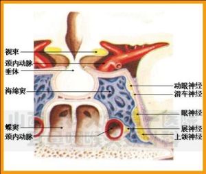 恶性青光眼 恶性青光眼