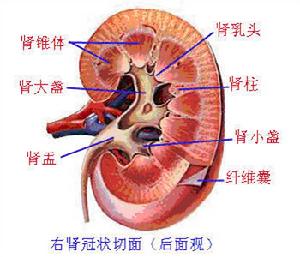 肾错构瘤