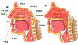 急性咽炎 急性咽炎