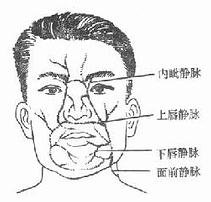 颜面部疖痈 颜面部疖痈