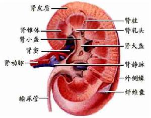 肾盂癌 肾盂癌