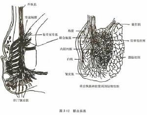 慢性盆腔炎 慢性盆腔炎