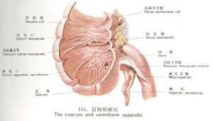 阑尾炎 阑尾炎