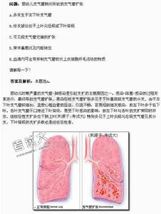支气管扩张 支气管扩张