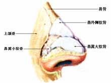 鼻骨骨折 鼻骨骨折