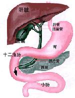 慢性胆囊炎 慢性胆囊炎