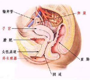 子宫内膜炎 子宫内膜炎