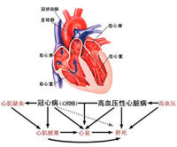 冠心病 冠心病
