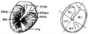 (图)中耳癌 (图)中耳癌