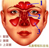 声带息肉