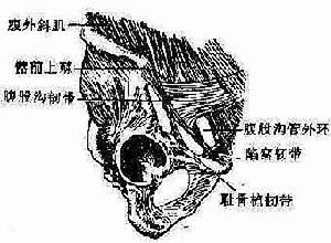 股疝