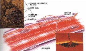 重症肌无力