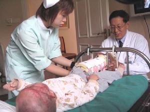 烧伤休克 烧伤休克