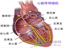 预激综合征 预激综合征