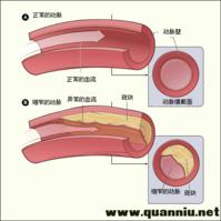病因分析