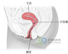 子宫息肉